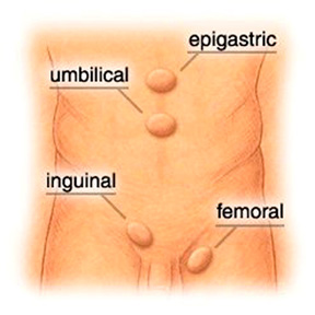 Pared abdominal